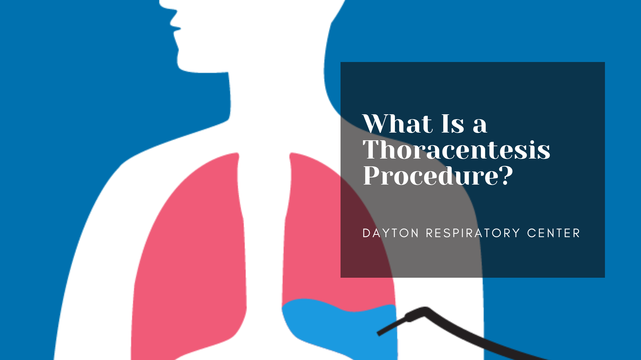 what-is-a-thoracentesis-procedure